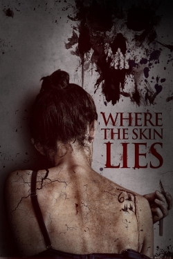 Where the Skin Lies-watch