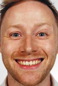 Limmy's Show-watch