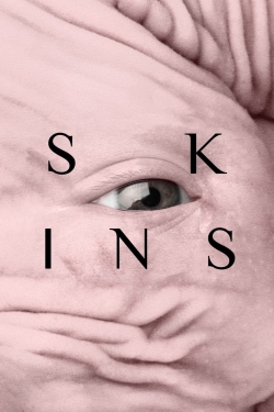 Skins-watch